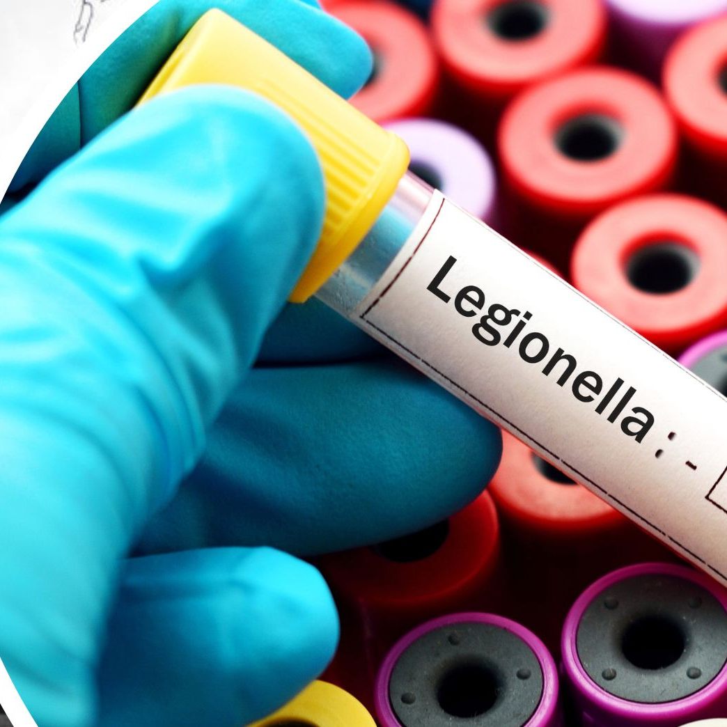 Jene 82-Jährige die im Wiener AKH an einer Legionellen-Infektion verstorben ist, dürfte sich nicht im Spital angesteckt haben.