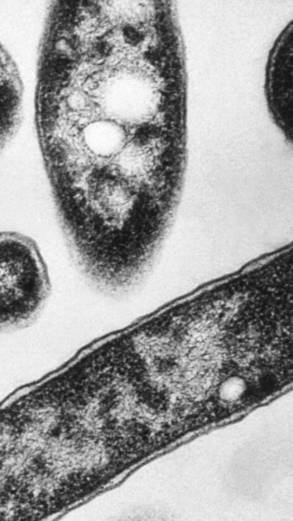 Bereits 19 Menschen sind bei einem Legionellenausbruch in Polen gestorben.