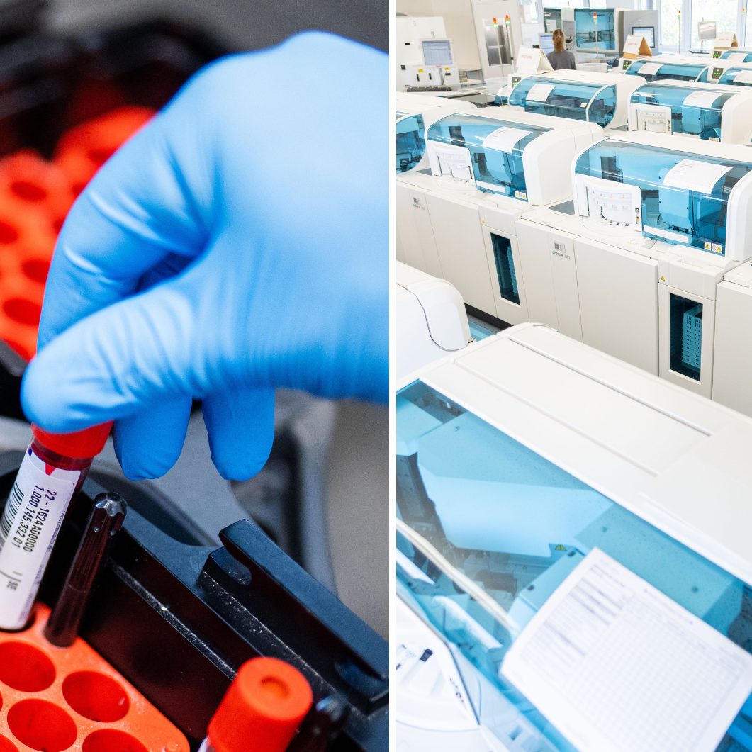 Blutlabore führen tausende Analysen pro Tag durch.