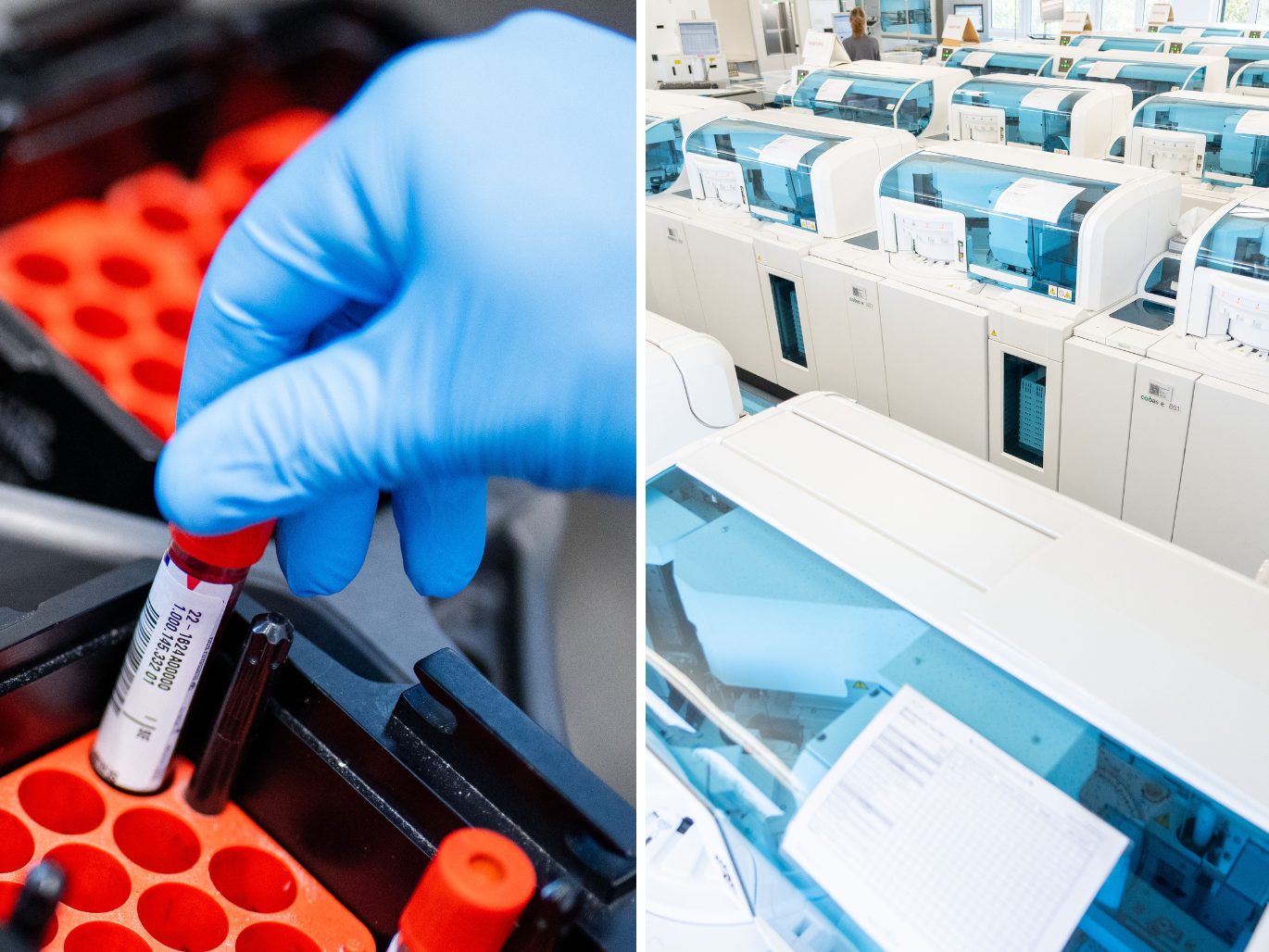 Blutlabore führen tausende Analysen pro Tag durch. Blutlabore führen tausende Analysen pro Tag durch.