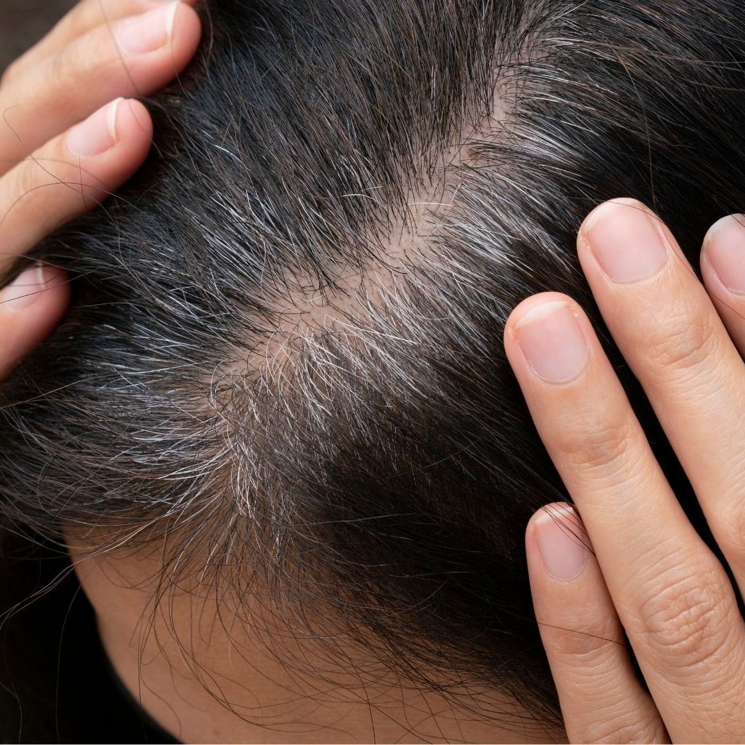 Wer bestimmte Lebensmittel konsumiert, hat bessere Chancen, erst später graue Haare zu bekommen.