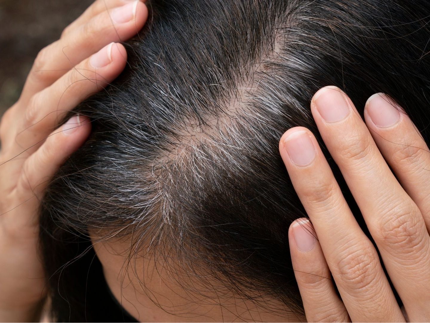 Wer bestimmte Lebensmittel konsumiert, hat bessere Chancen, erst später graue Haare zu bekommen. Wer bestimmte Lebensmittel konsumiert, hat bessere Chancen, erst später graue Haare zu bekommen.