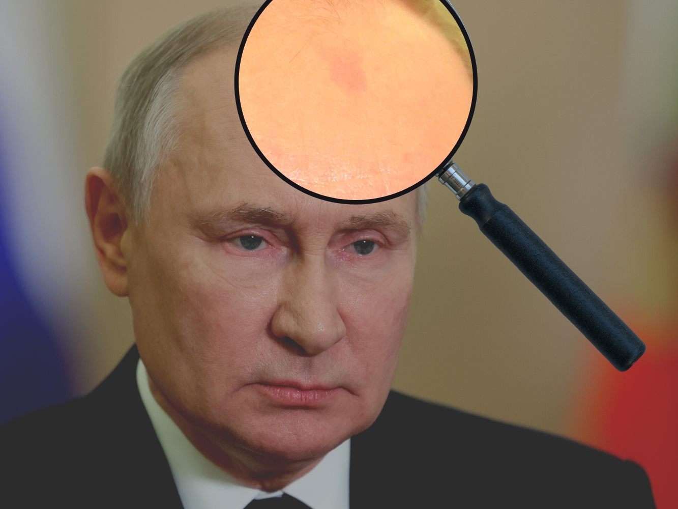 Putins mysteriöser Fleck auf der Stirn