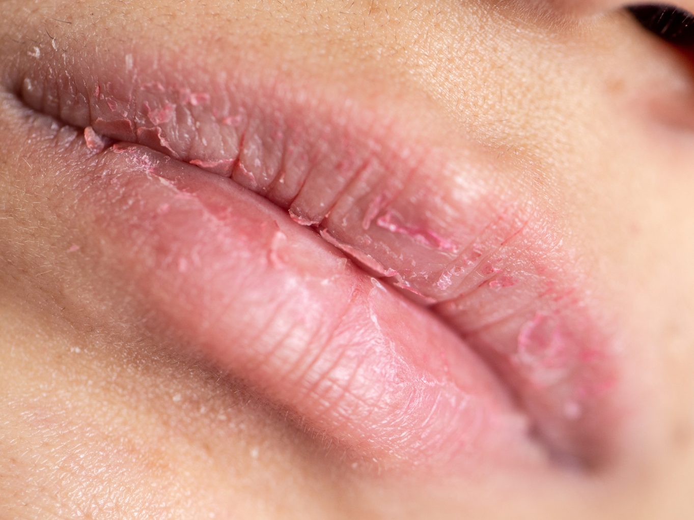 Ganz gleich, ob es die eisige Außenluft oder die trockene Heizungsluft drinnen ist – beide entziehen der Haut um die Lippen Feuchtigkeit und zählen zu den Hauptursachen für spröde Lippen im Winter. Ganz gleich, ob es die eisige Außenluft oder die trockene Heizungsluft drinnen ist – beide entziehen der Haut um die Lippen Feuchtigkeit und zählen zu den Hauptursachen für spröde Lippen im Winter.