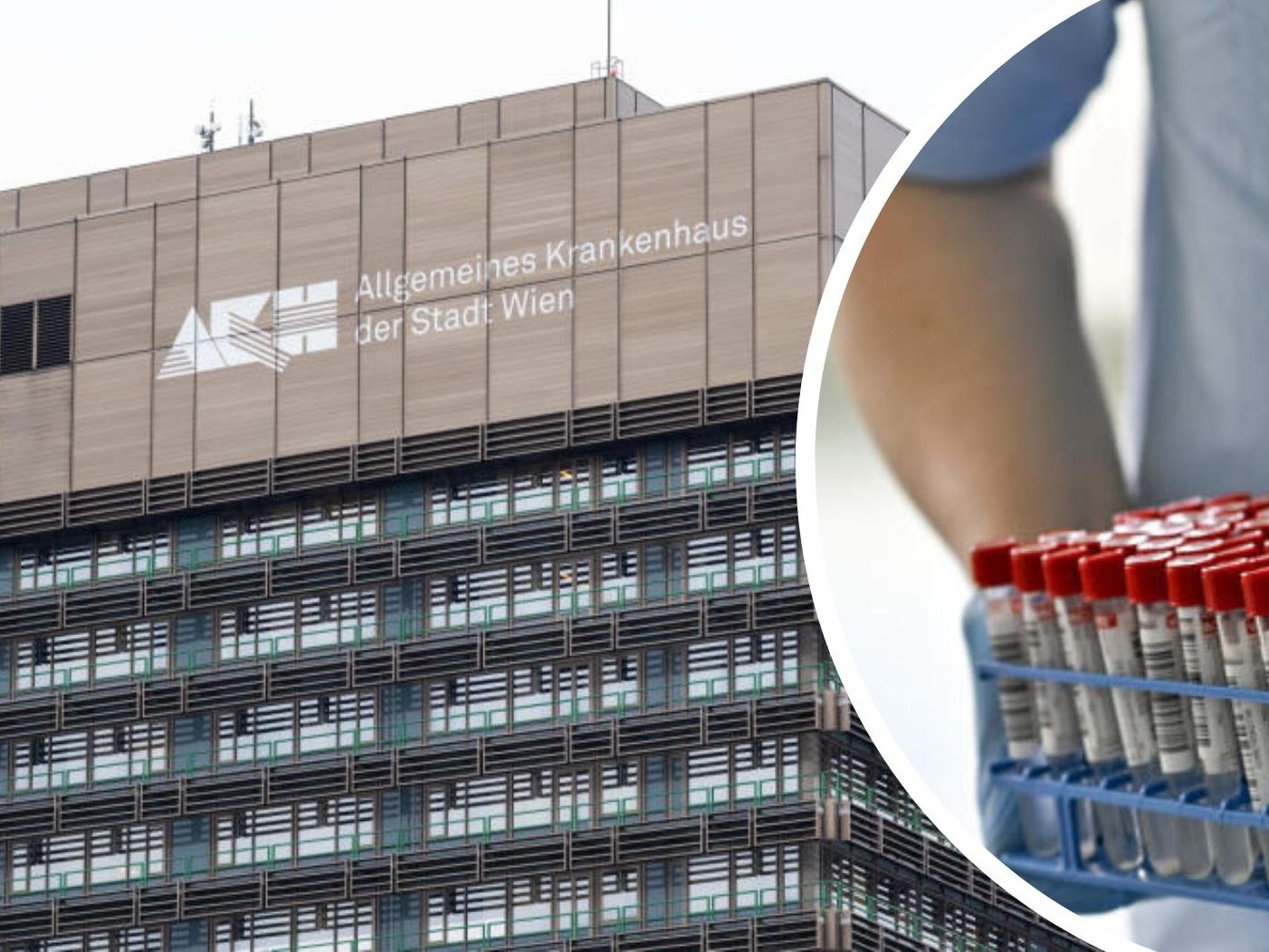 Das AKH Wien testet ab Dienstag stationäre Patienten auf das Coronavirus. Das AKH Wien testet ab Dienstag stationäre Patienten auf das Coronavirus.