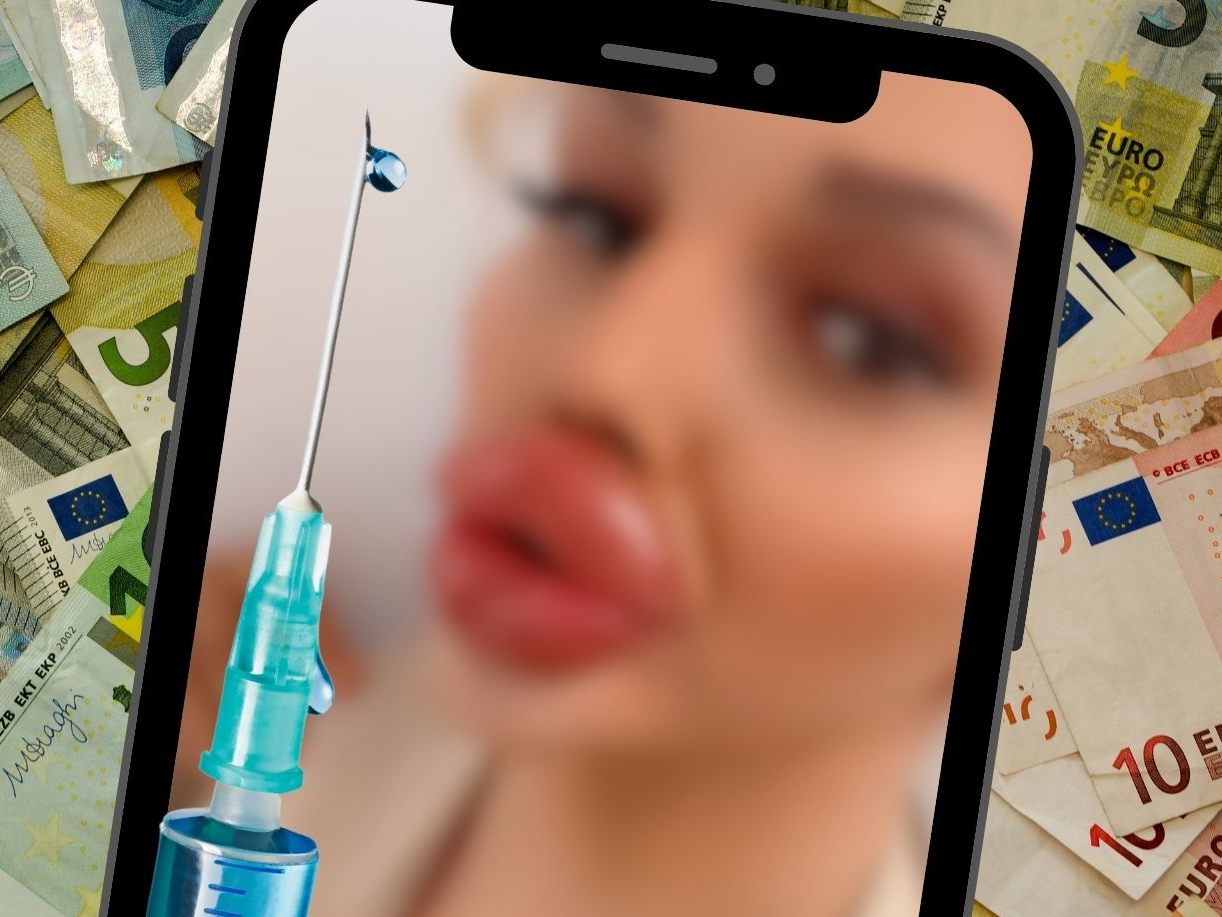 Influencerin mit den dicksten Lippen