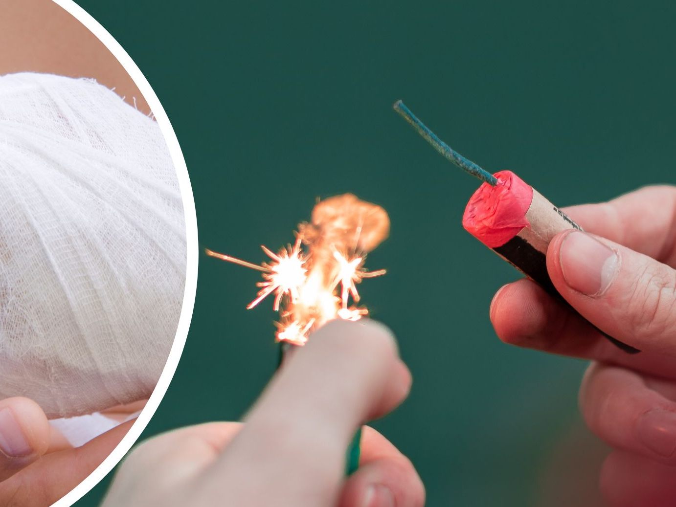 Weil ihm ein Böller in der Hand explodierte, wurde ein 12-jähriger Bub in Wiener Neustadt verletzt. Weil ihm ein Böller in der Hand explodierte, wurde ein 12-jähriger Bub in Wiener Neustadt verletzt.