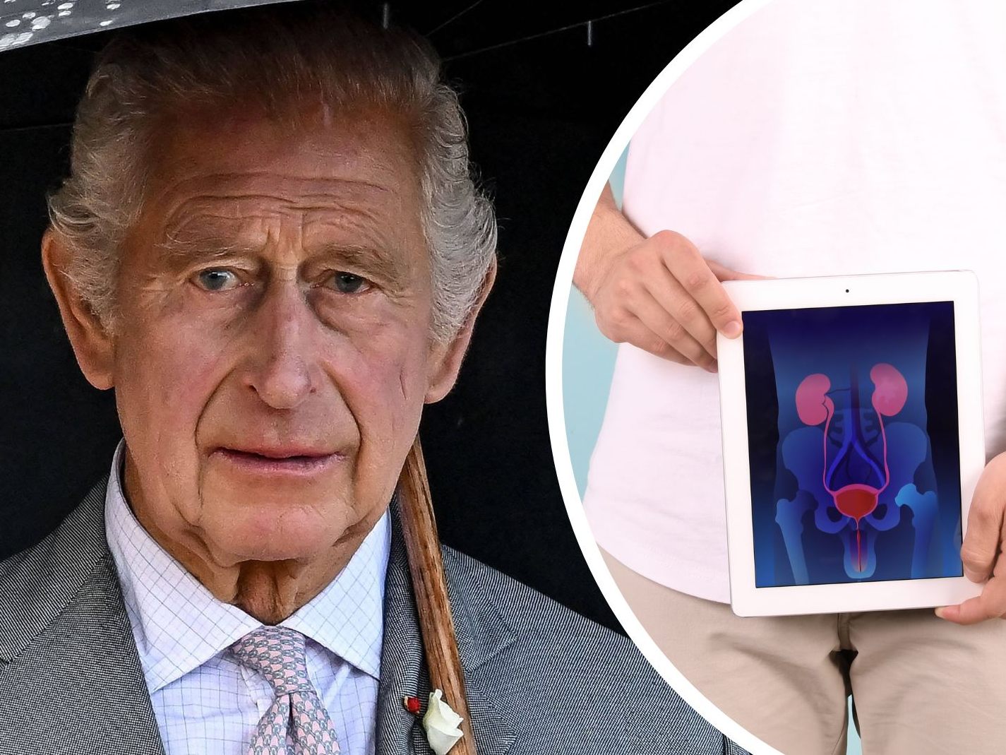 Warum König Charles bald ins Spital muss. Warum König Charles bald ins Spital muss.