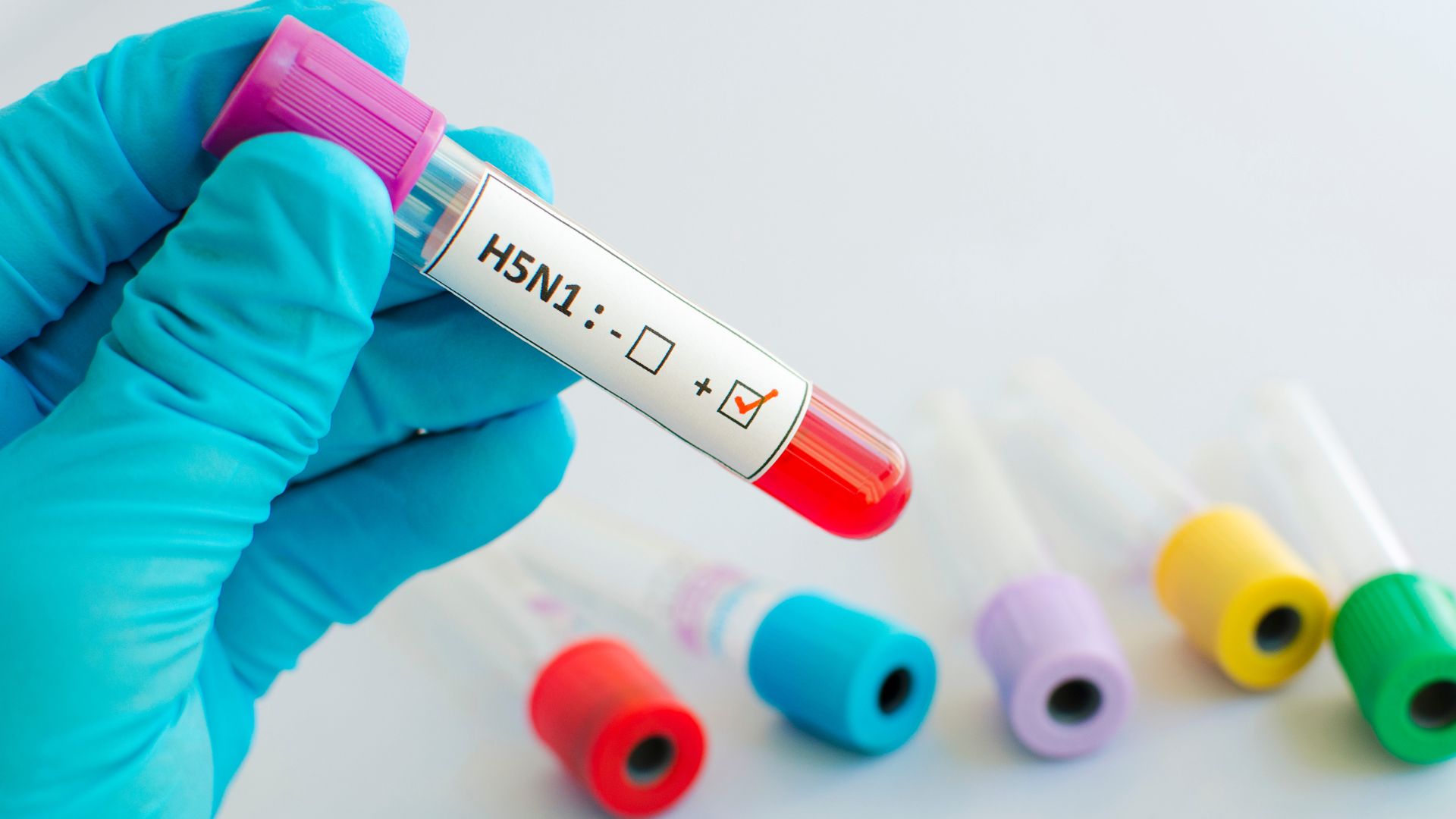 Der Virus kann schwere Schäden in den Organen hervorrufen, vor allem in Lungen und Nieren, was letztendlich zum Tod führt. Die hohe Virulenz von Stämmen wie H5N1 führt oft zu einer schnellen Verschlechterung des Gesundheitszustandes der infizierten Tiere. Der Virus kann schwere Schäden in den Organen hervorrufen, vor allem in Lungen und Nieren, was letztendlich zum Tod führt. Die hohe Virulenz von Stämmen wie H5N1 führt oft zu einer schnellen Verschlechterung des Gesundheitszustandes der infizierten Tiere.