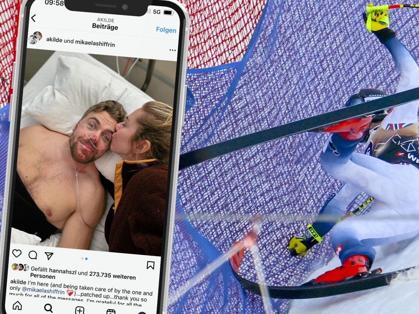 Skistar Aleksander Aamodt Kilde wurde nach einem schweren Sturz in der Abfahrt von Wengen in Bern operiert. Skistar Aleksander Aamodt Kilde wurde nach einem schweren Sturz in der Abfahrt von Wengen in Bern operiert.