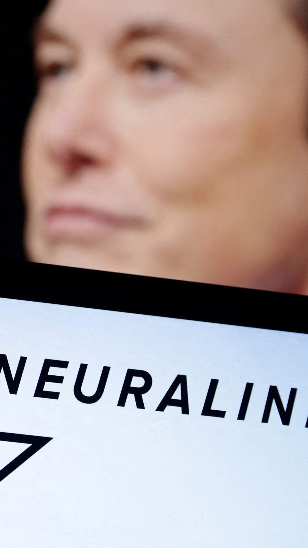 Elon Musk meldete einen Erfolg bei der Verpflanzung eines Gehirnchips.