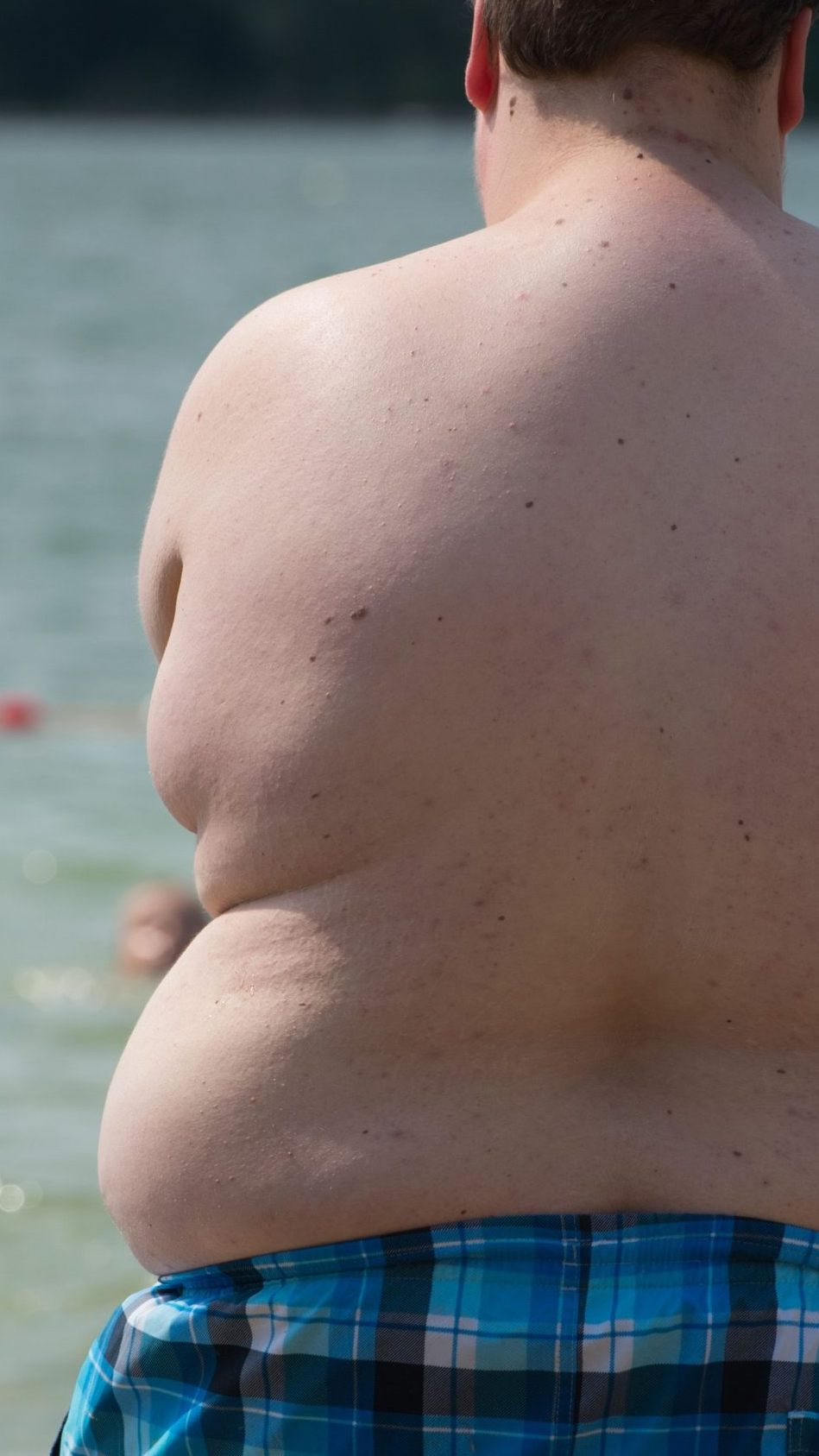 Mehr als die Hälfte der österreichischen Bevölkerung ist übergewichtig.