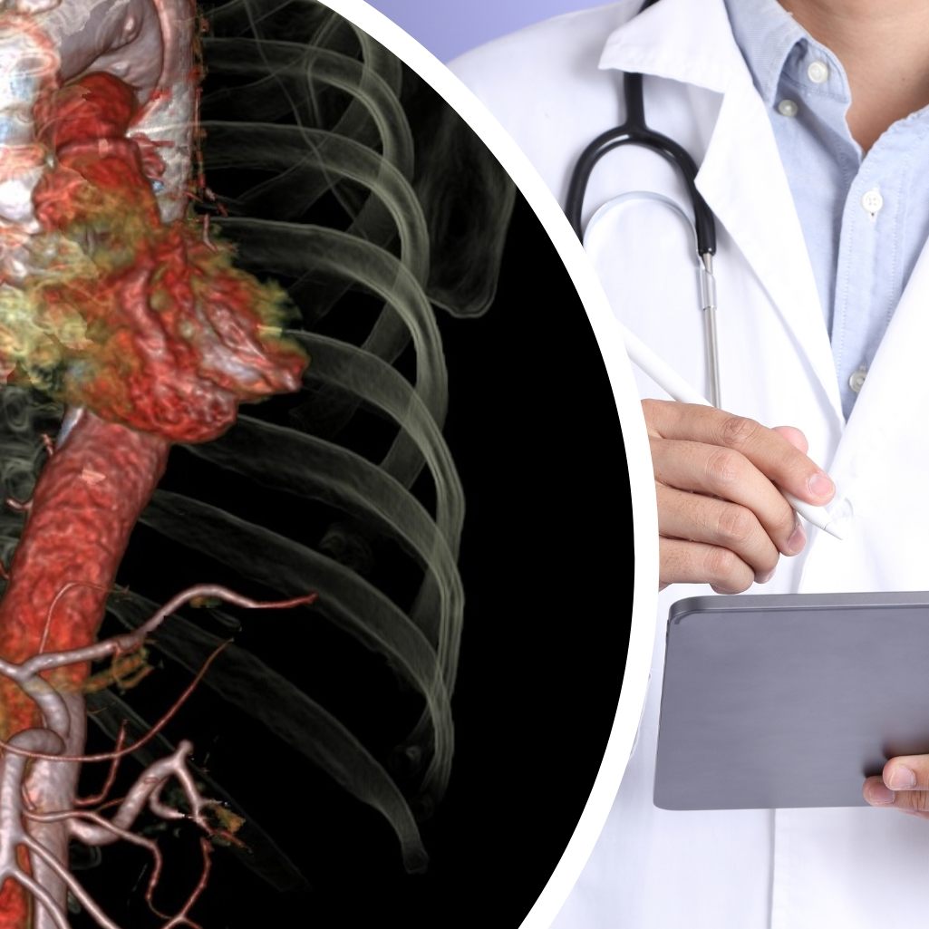 Aorta als Organ anerkannt