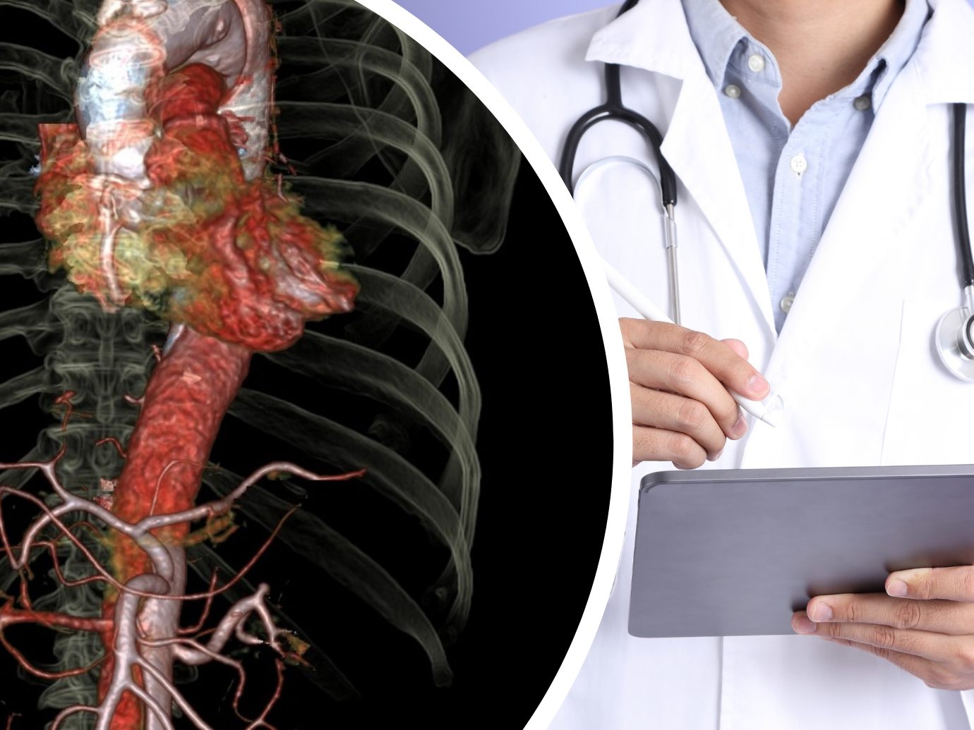 Aorta als Organ anerkannt Aorta als Organ anerkannt