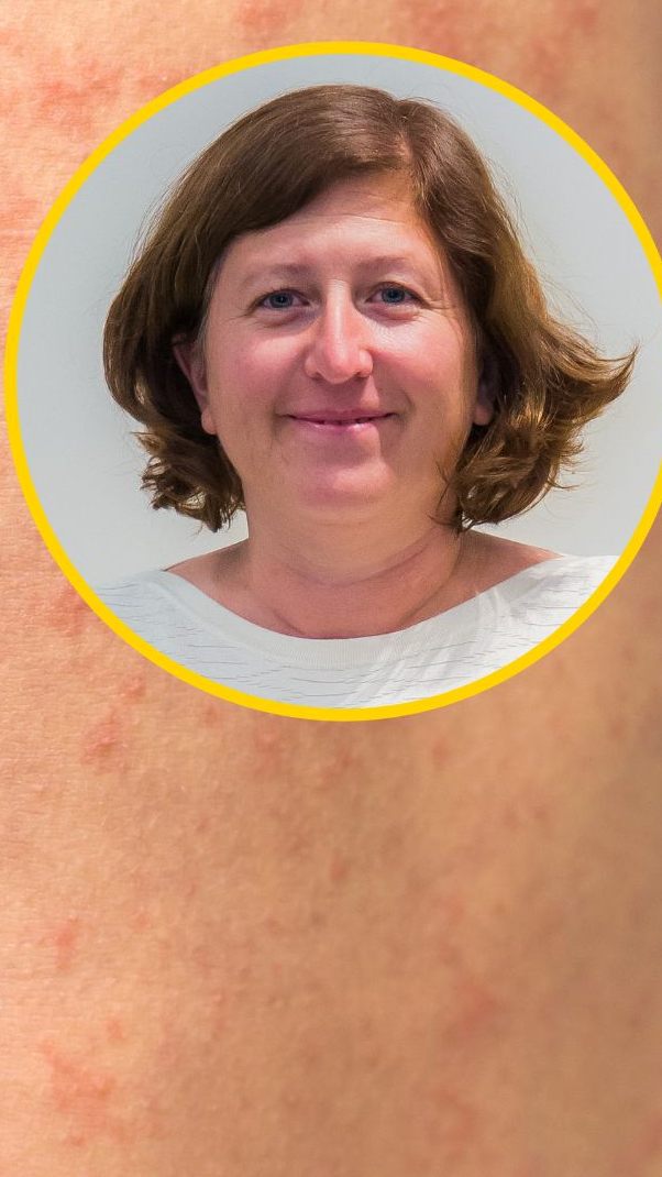 Dr. Daniela Jonas warnt zur Vorsicht und macht sich für die Masern-Impfung stark.