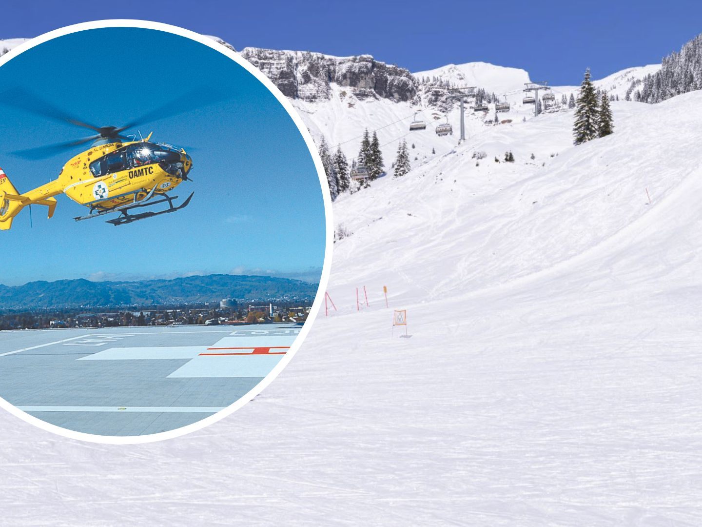 Nach schweren Verletzungen im Krankenhaus verstorben Nach schweren Verletzungen im Krankenhaus verstorben