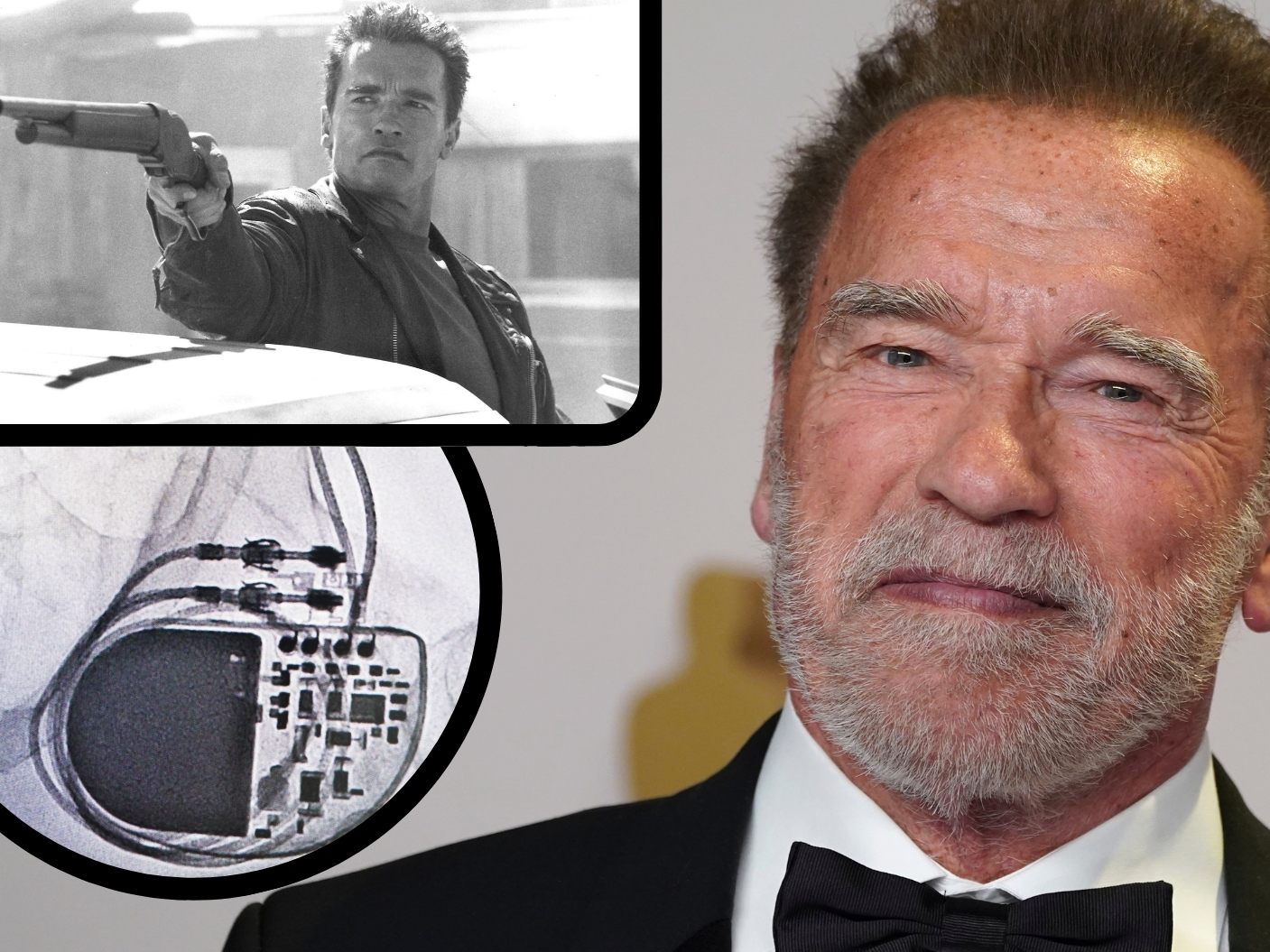 Der "Terminator" bekam Herzschrittmacher Der "Terminator" bekam Herzschrittmacher