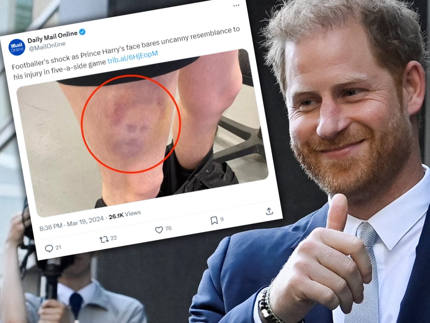 Dieser blaue Fleck hat verblüffende Ähnlichkeit mit Prinz Harry. Dieser blaue Fleck hat verblüffende Ähnlichkeit mit Prinz Harry.