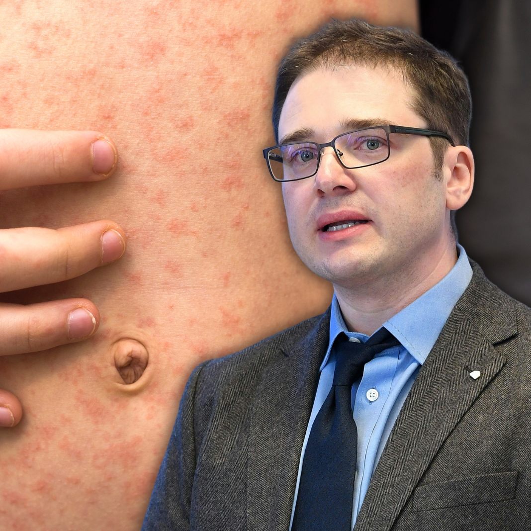 Virologe Lukas Weseslindtner (MedUni Wien/Nationales Referenzzentrum für Masern) ist angesichts der Fallzahlen besorgt.