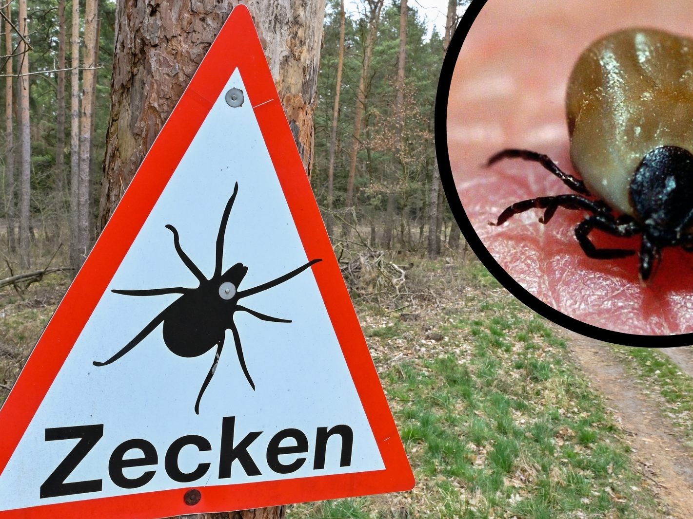 Ein oft unbemerkter Biss und seine möglichen Folgen (Symbolbild)