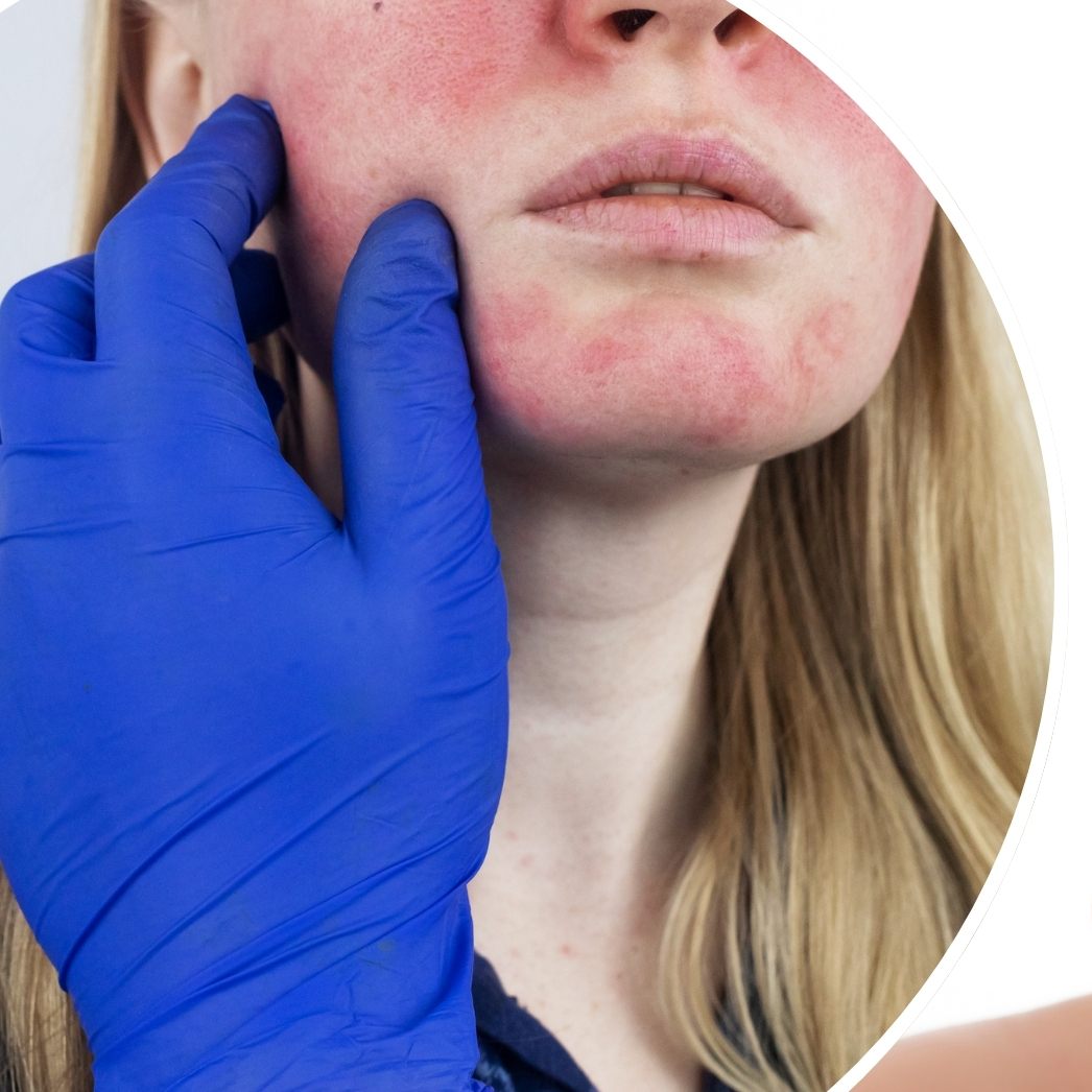 Merkmale im Gesicht können auf ernsthafte Krankheiten hindeuten.