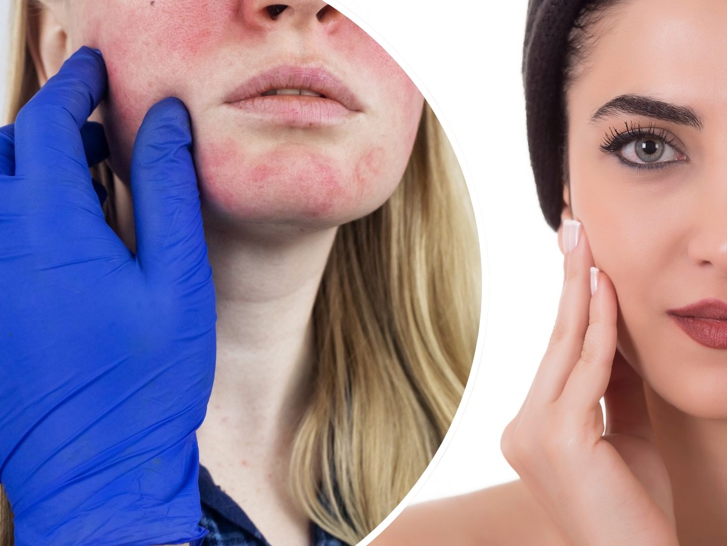 Merkmale im Gesicht können auf ernsthafte Krankheiten hindeuten.