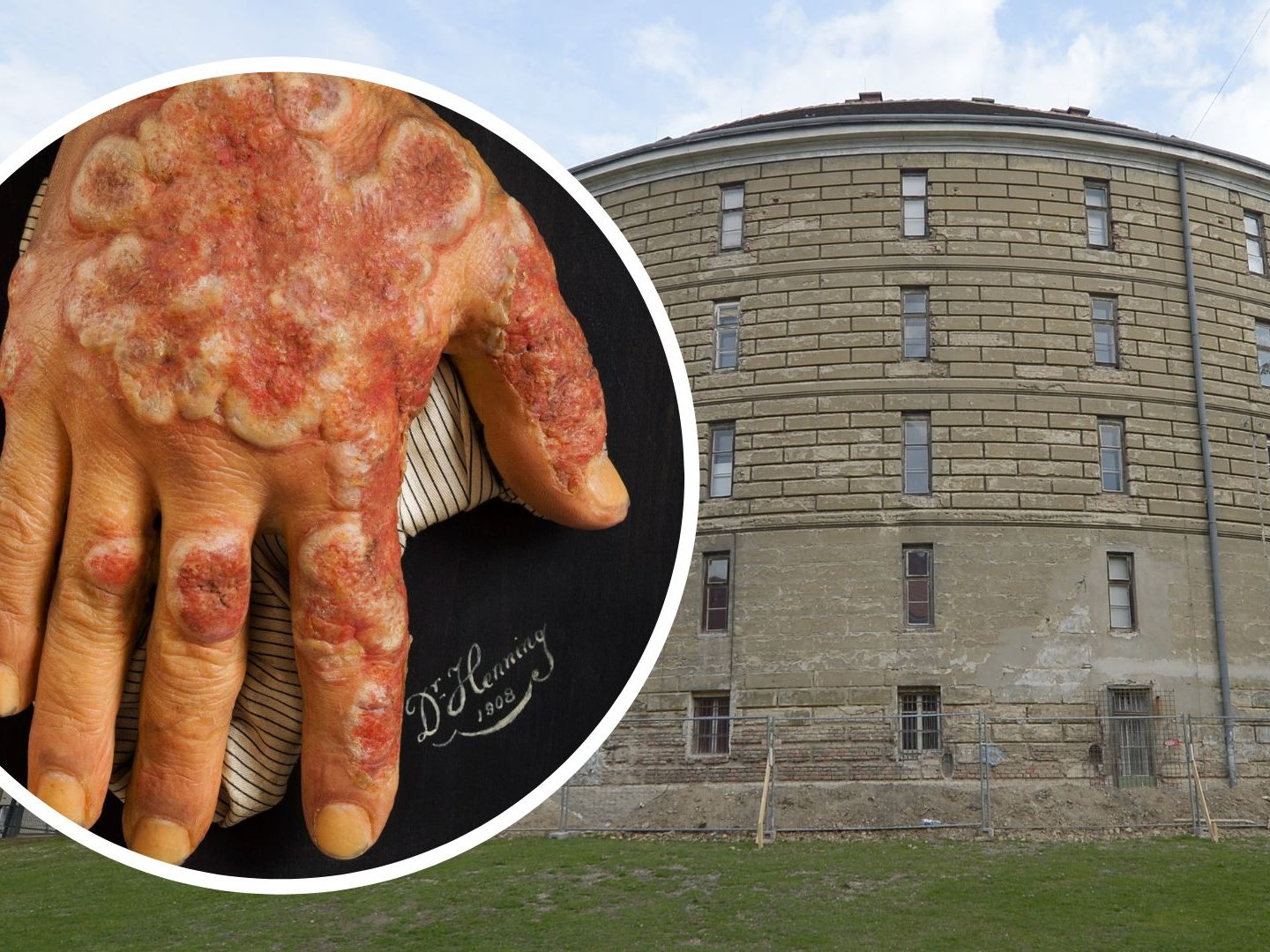 Der Narrenturm zeigt in einer Sonderschau "verewigte Krankheitsbilder". Der Narrenturm zeigt in einer Sonderschau "verewigte Krankheitsbilder".