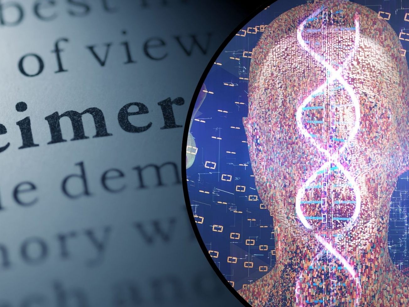 Forscher vermelden einen Durchbruch in der Alzheimer-Forschung. Forscher vermelden einen Durchbruch in der Alzheimer-Forschung.
