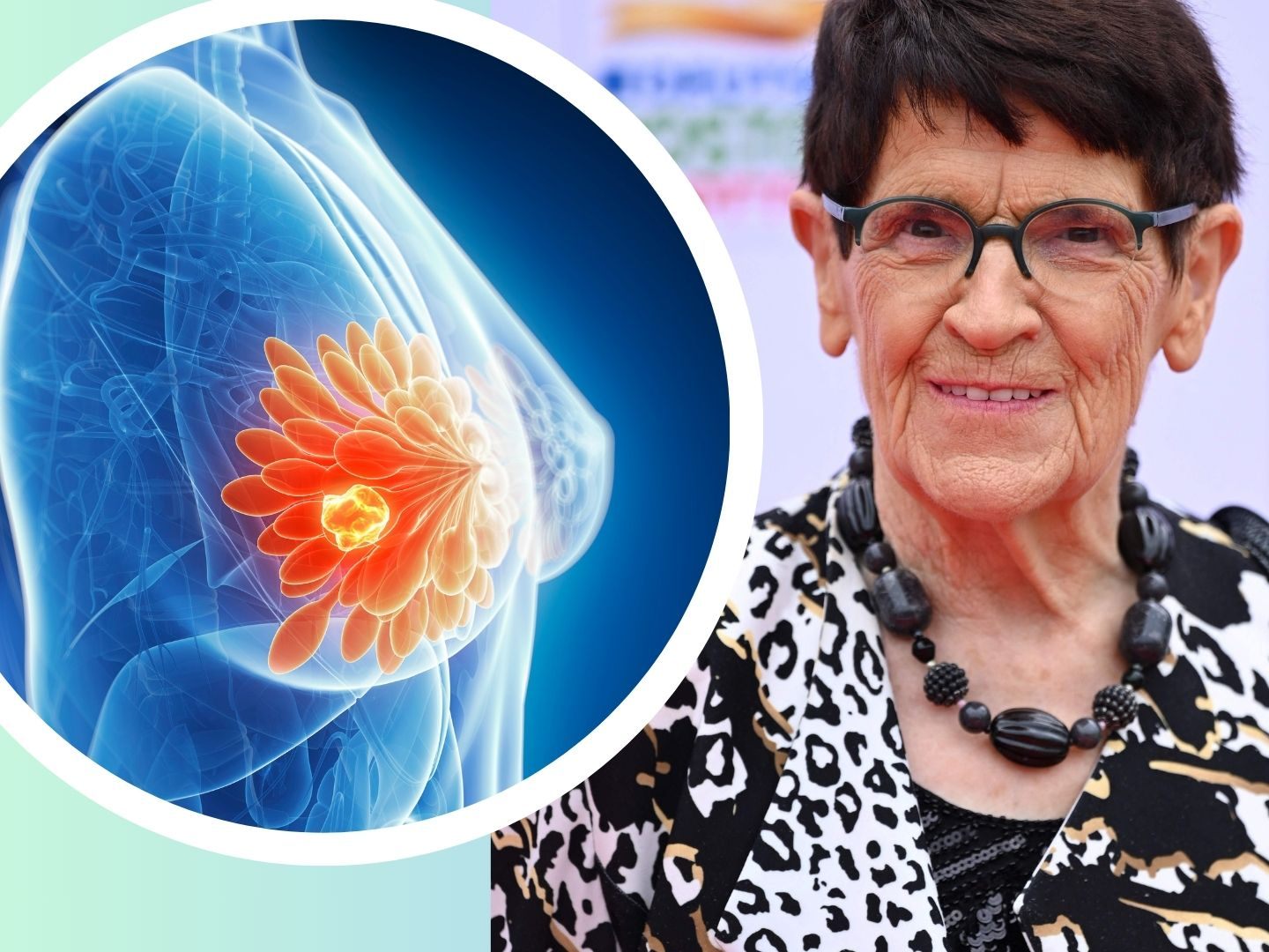 "Lasse mich nicht unterkriegen" - Rita Süssmuth hat Brustkrebs