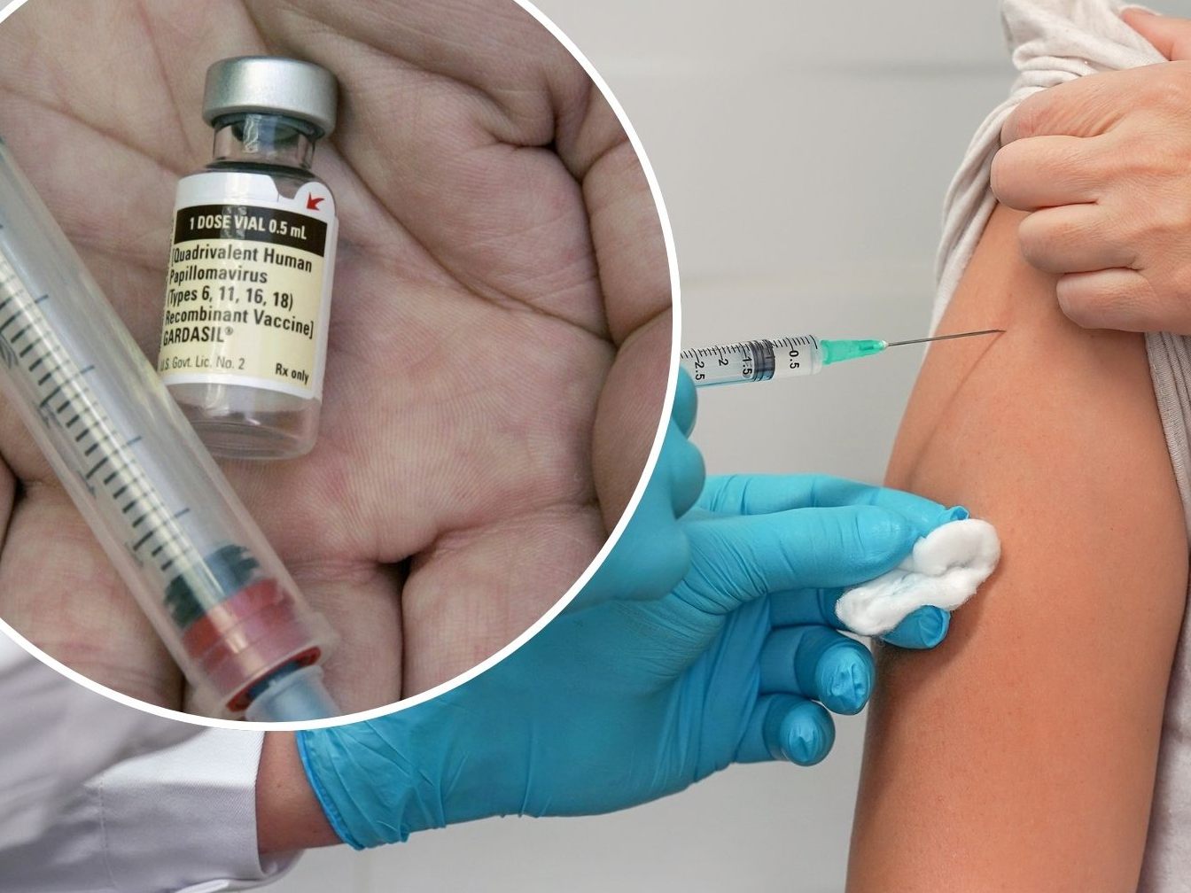 Ab dem 1. Juli 2024 ist die HPV-Impfung in Vorarlberg bis zum Alter von 30 Jahren kostenlos. Bislang war diese nur bis zum 21. Lebensjahr kostenfrei erhältlich.