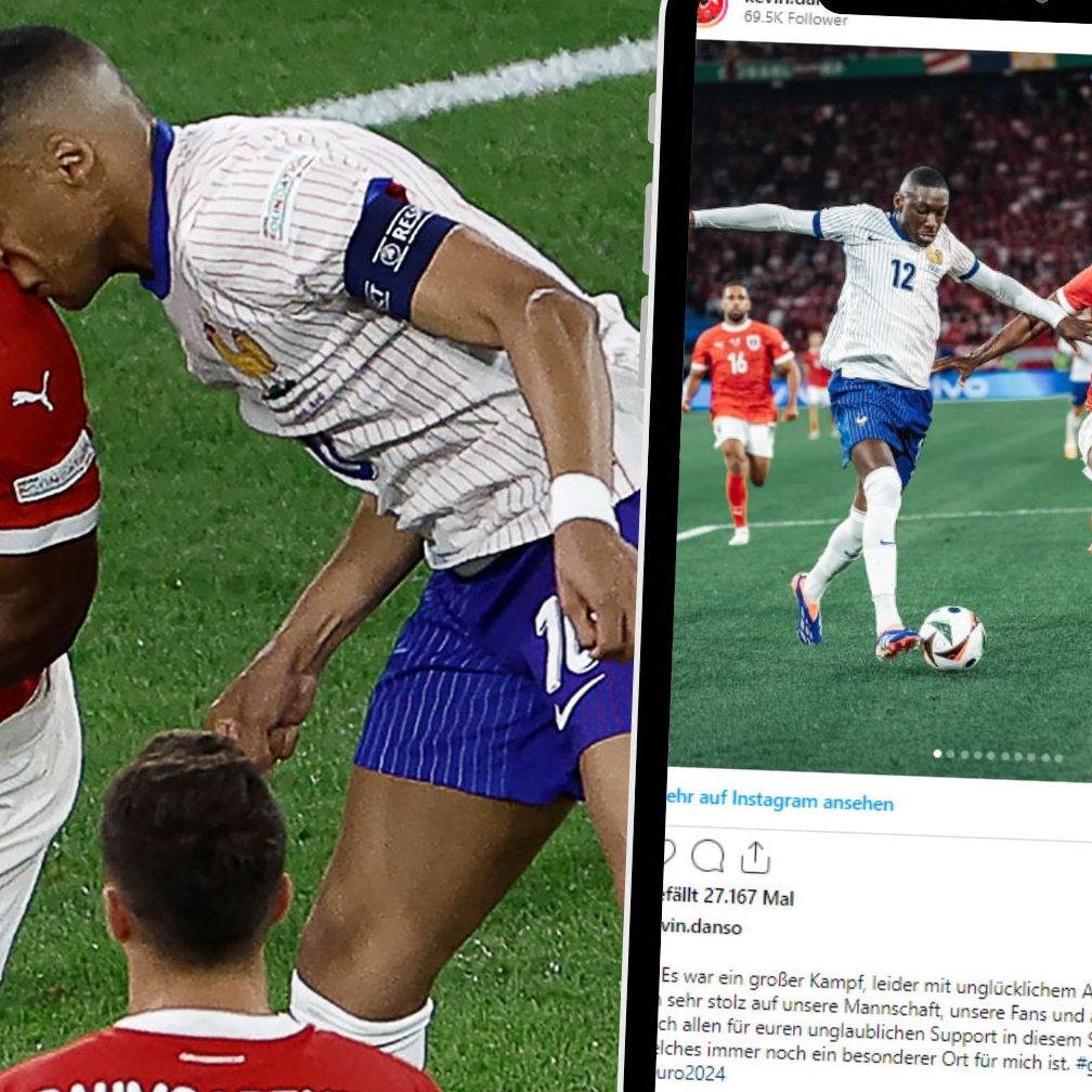 Am Montagabend zog sich der französische Fußballstar Kylian Mbappé (25) im Luftduell mit dem österreichischen Verteidiger Kevin Danso einen Nasenbeinbruch zu.