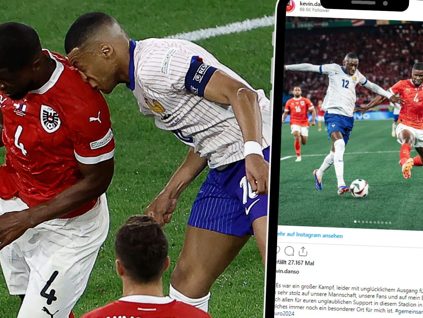 Am Montagabend zog sich der französische Fußballstar Kylian Mbappé (25) im Luftduell mit dem österreichischen Verteidiger Kevin Danso einen Nasenbeinbruch zu.