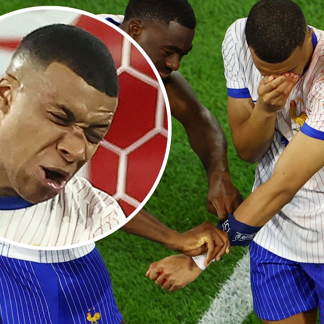 Nasenbeinbruch bei EM-Spiel