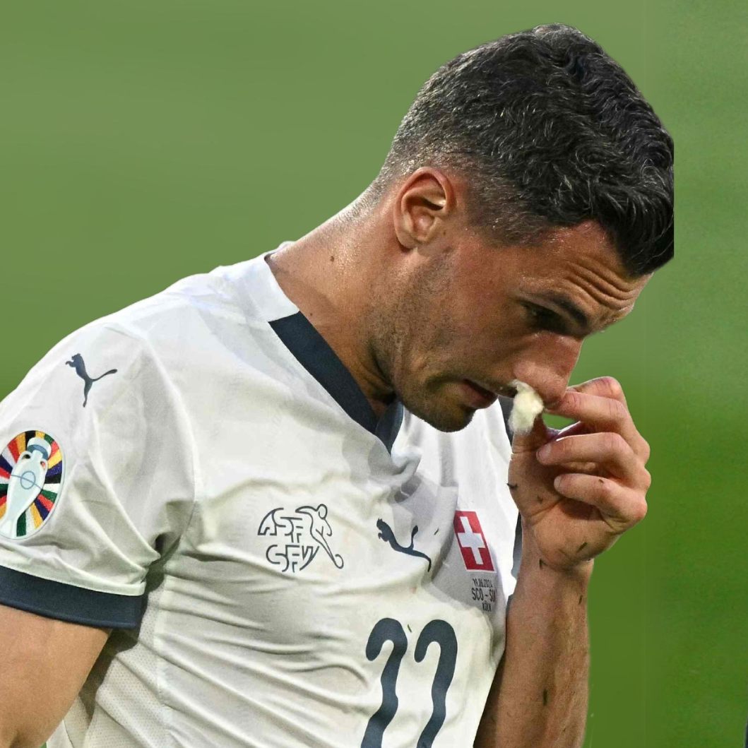 Der Schweizer Fabian Schär spielte mit gebrochener Nase weiter.