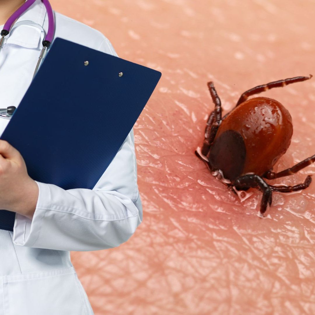 Zeckenbisse können für Menschen gefährlich sein