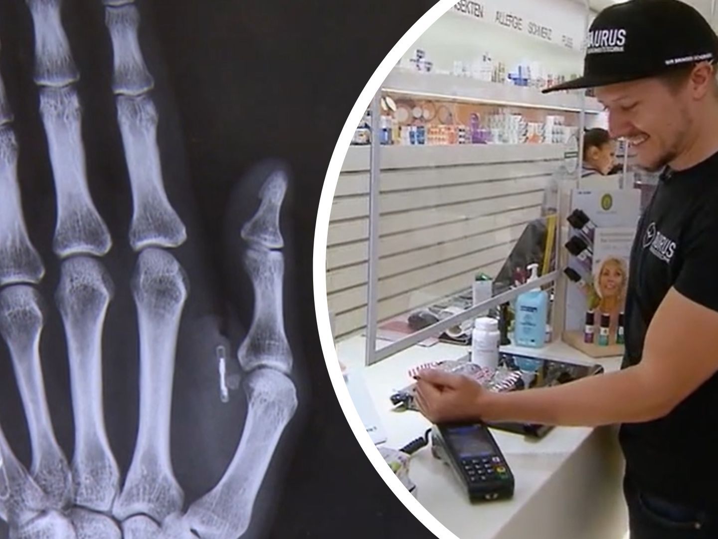 Mit den Chips in seinen Händen kann Urbanek bezahlen, Türen öffnen oder das Auto starten.