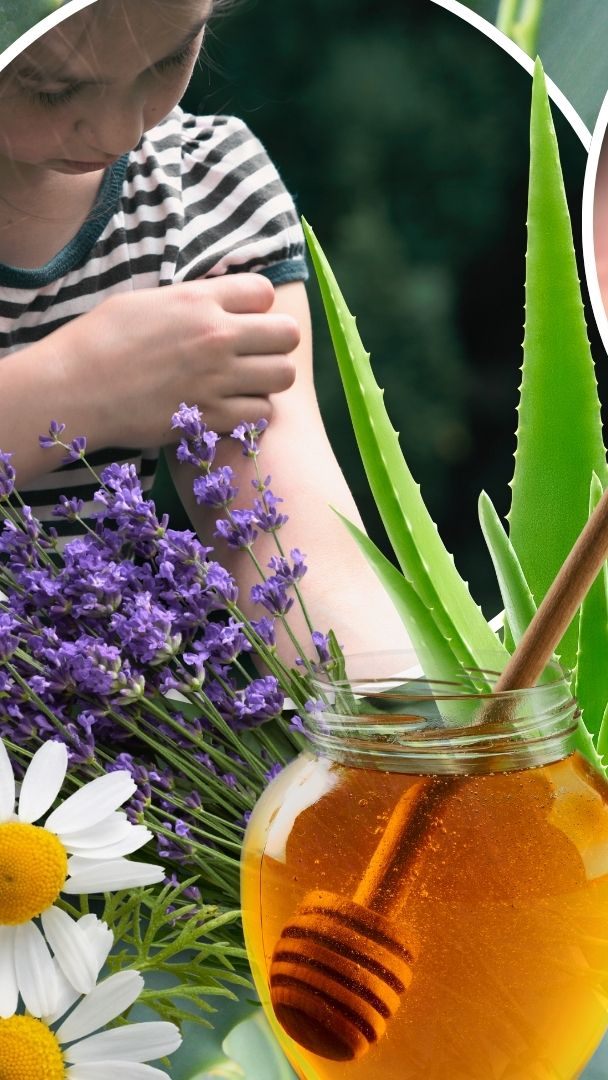 Bei Mückenstichen können verschiedene Hausmittel helfen, diese Symptome zu lindern.