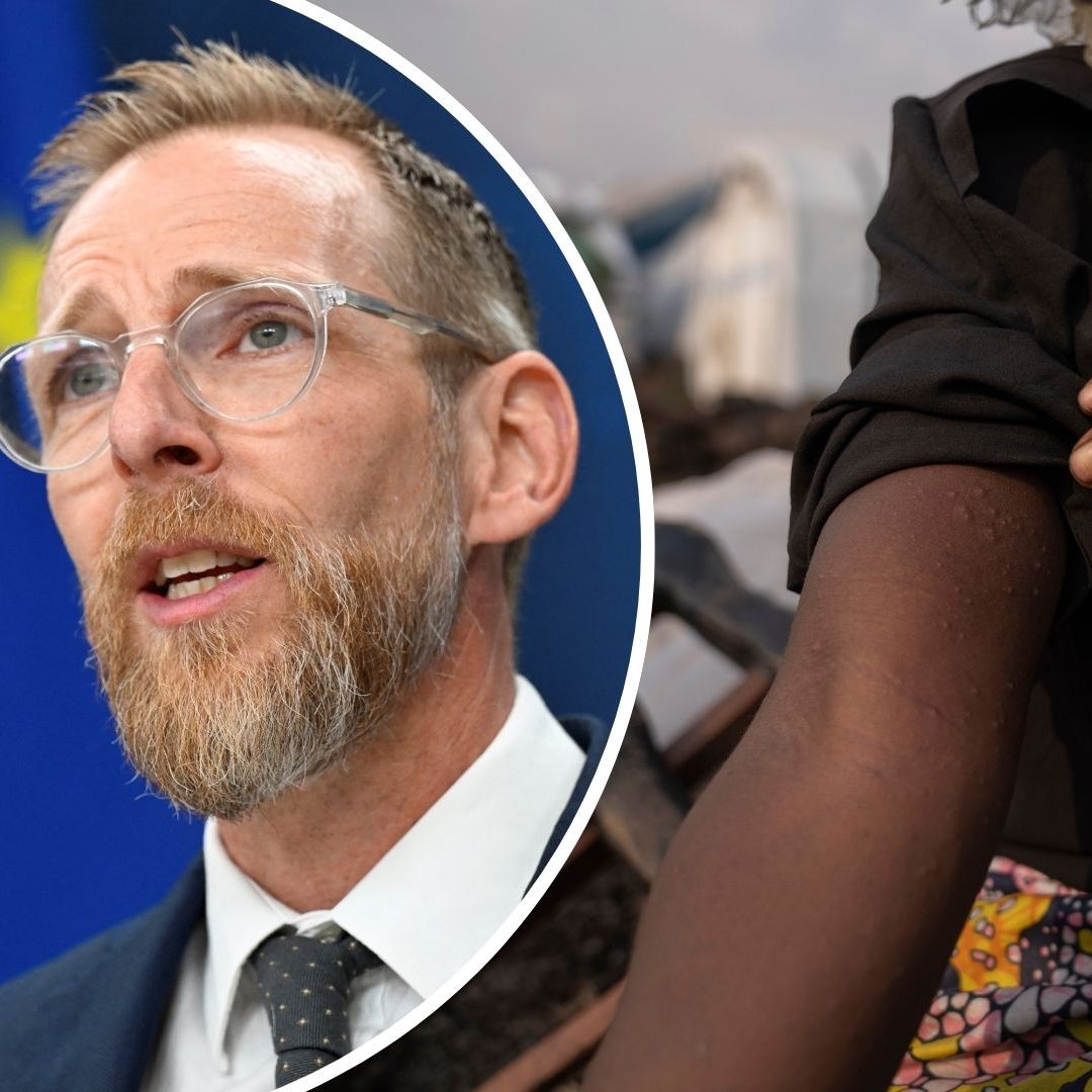 In Schweden wurde der erste Mpox-Fall der neuen Variante Klade I außerhalb Afrikas bestätigt.