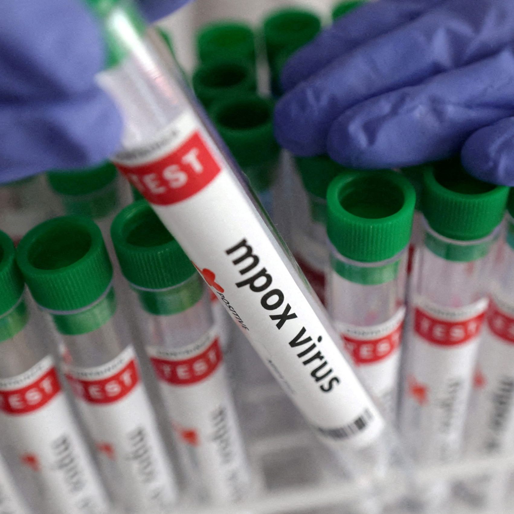 Fake-News über Mpox verbreiten sich.