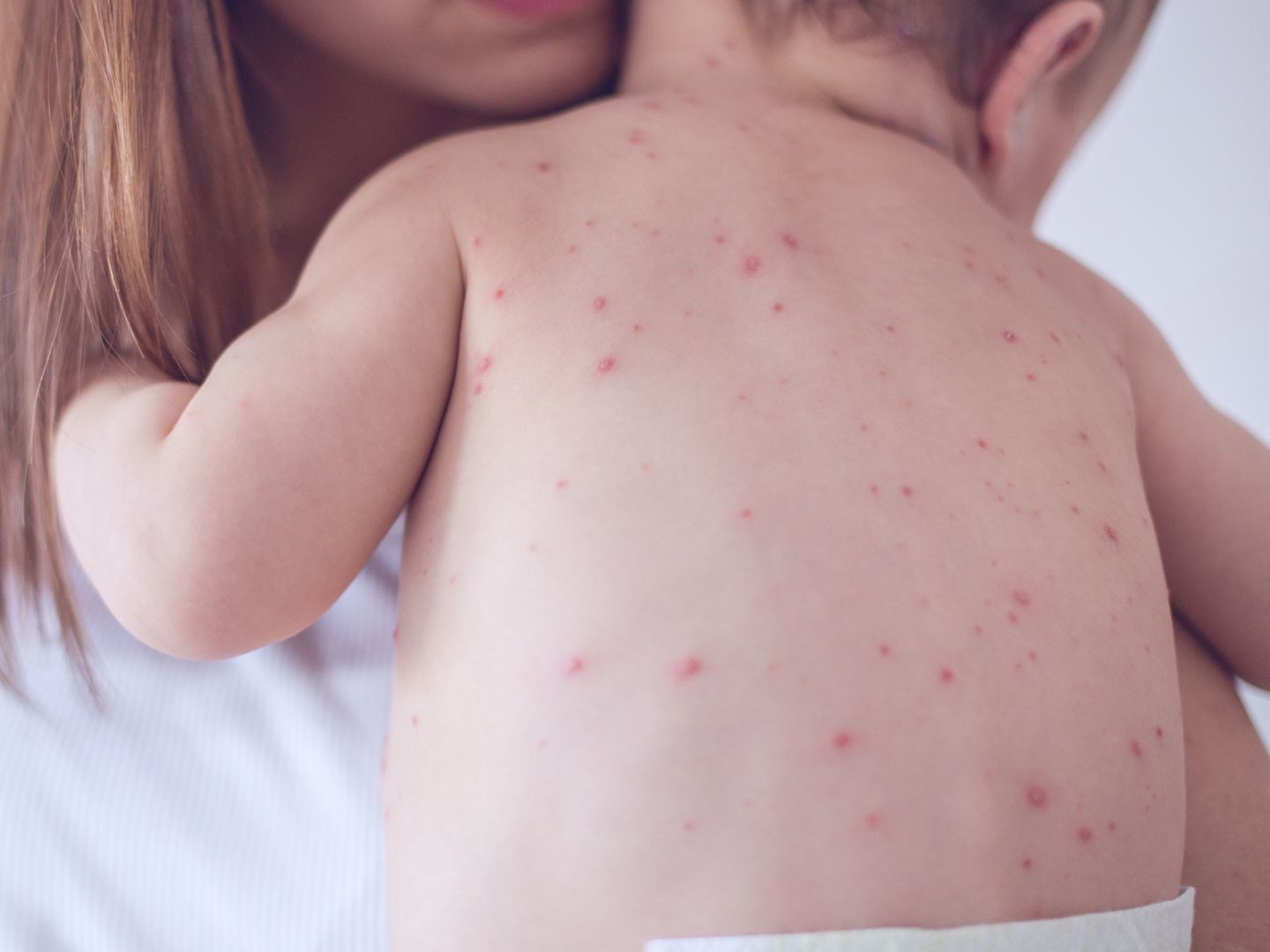 Eine hohe Durchimpfungsrate würde das Virus ausrotten .