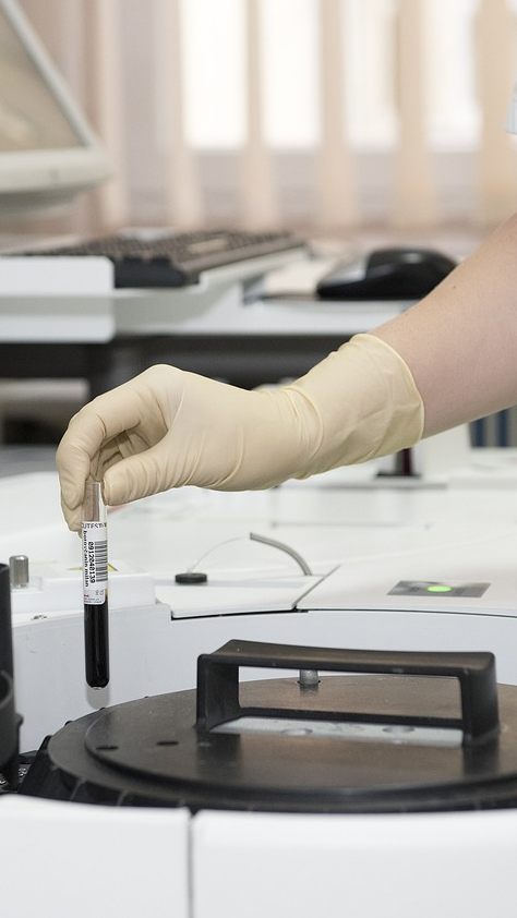 Krebspatienten haben ein Risiko für häufigere und schwerere Blutungen.