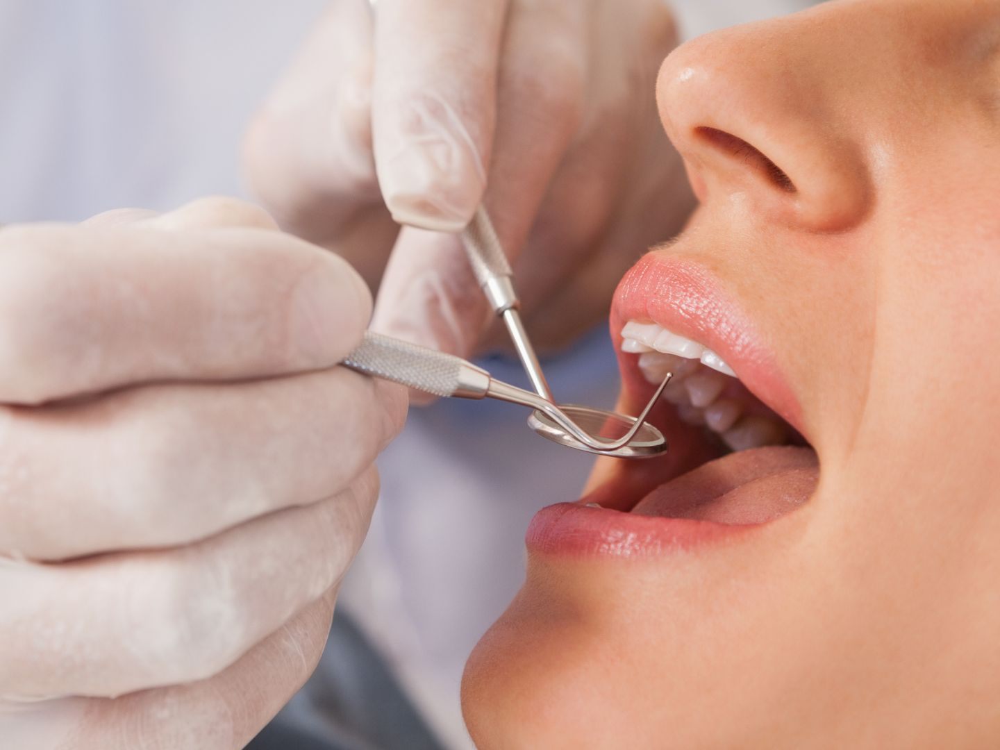 Die ÖGK setzt bei Zahnfüllungen auf Alternativen zu Amalgam. Die ÖGK setzt bei Zahnfüllungen auf Alternativen zu Amalgam.