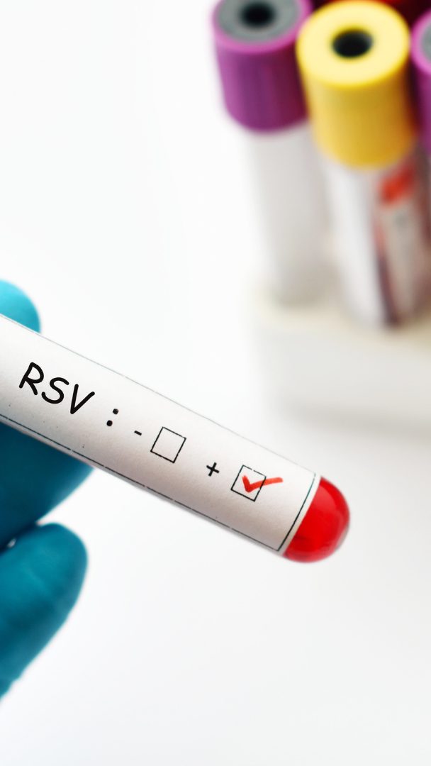 Einer RSV-Infektion entgeht fast kein Kind.