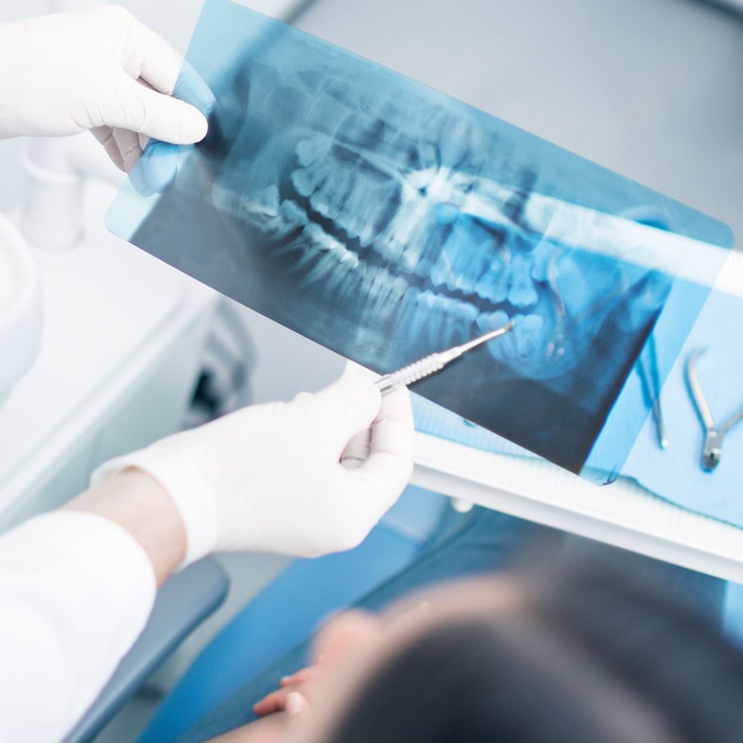 Zahnfüllungen werden ab 2025 wohl zur Privatleistung.