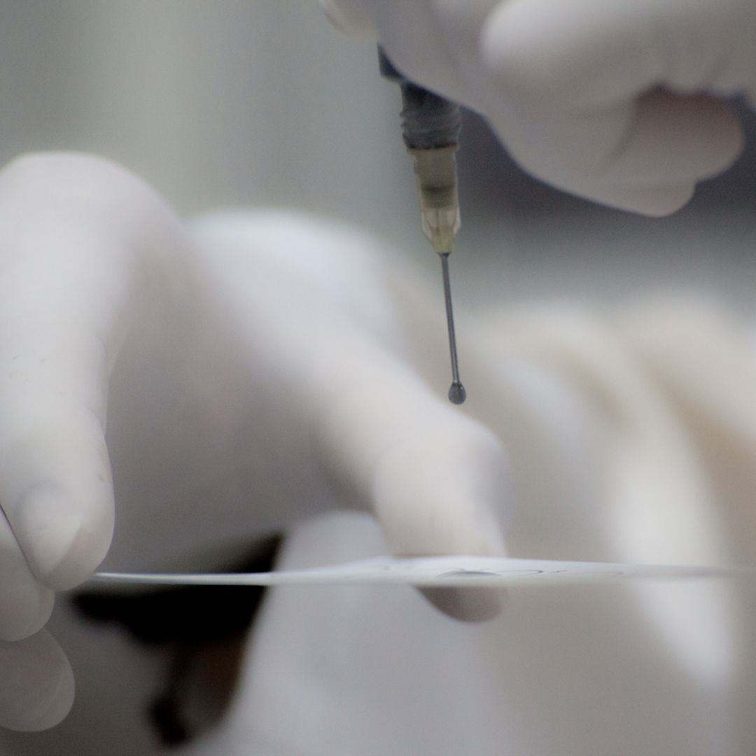 Die ÖH stellt kostenlose Tests für Studierende zur Verfügung, um sexuell übertragbare Krankheiten zu reduzieren.