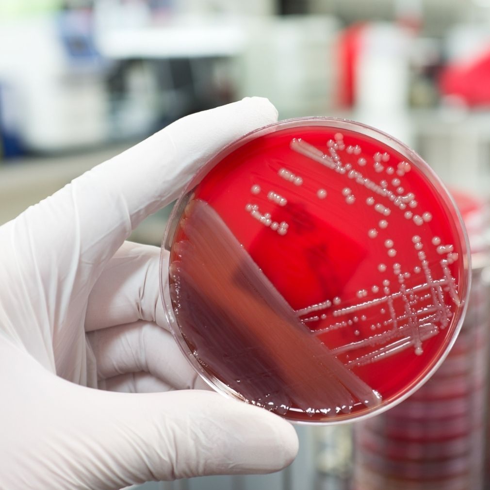 Die WHO veröffentlichte erstmals eine Liste mit den gefährlichsten Viren und Bakterien. (Symbolbild)