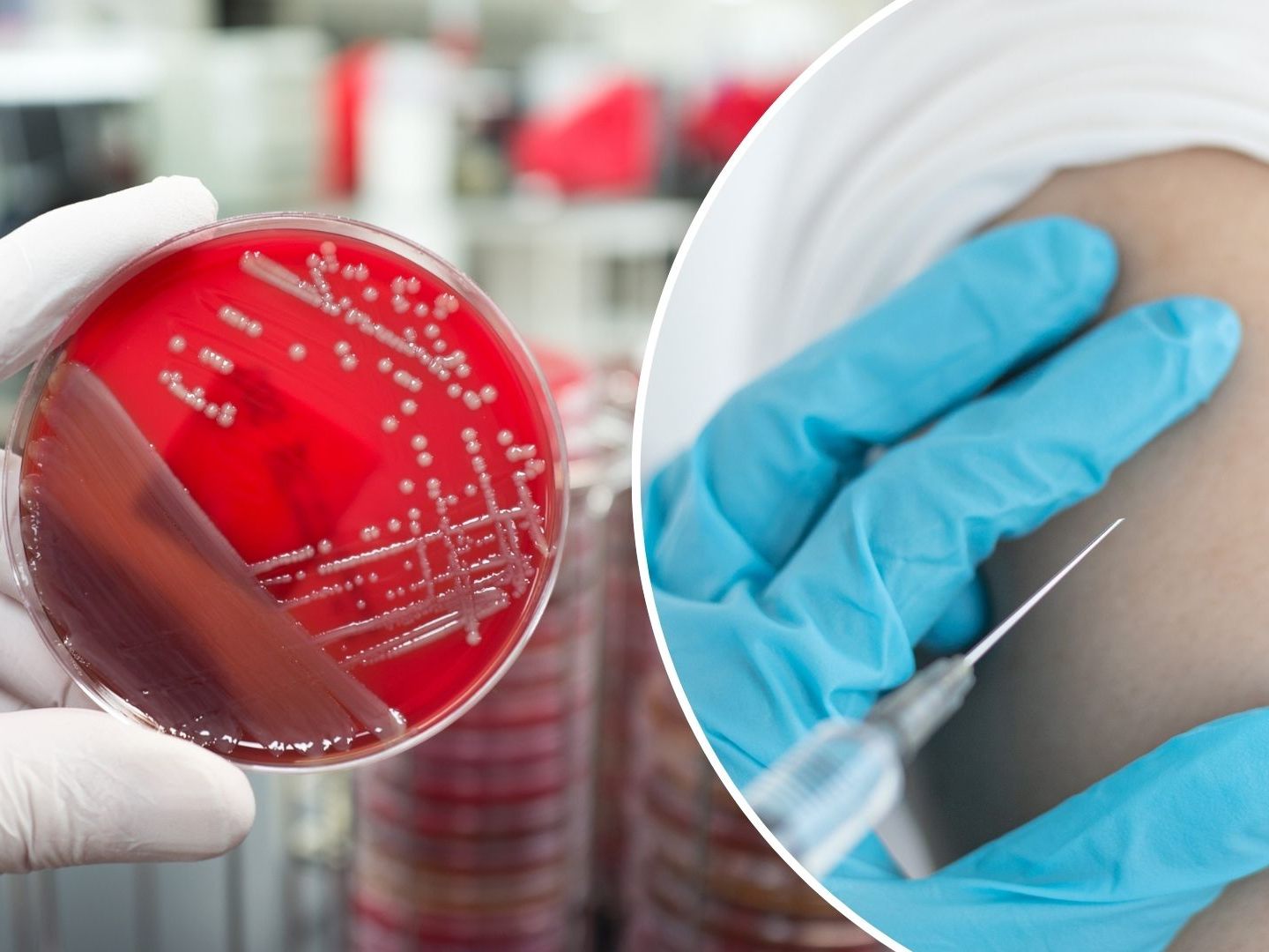 Die WHO veröffentlichte erstmals eine Liste mit den gefährlichsten Viren und Bakterien. (Symbolbild)