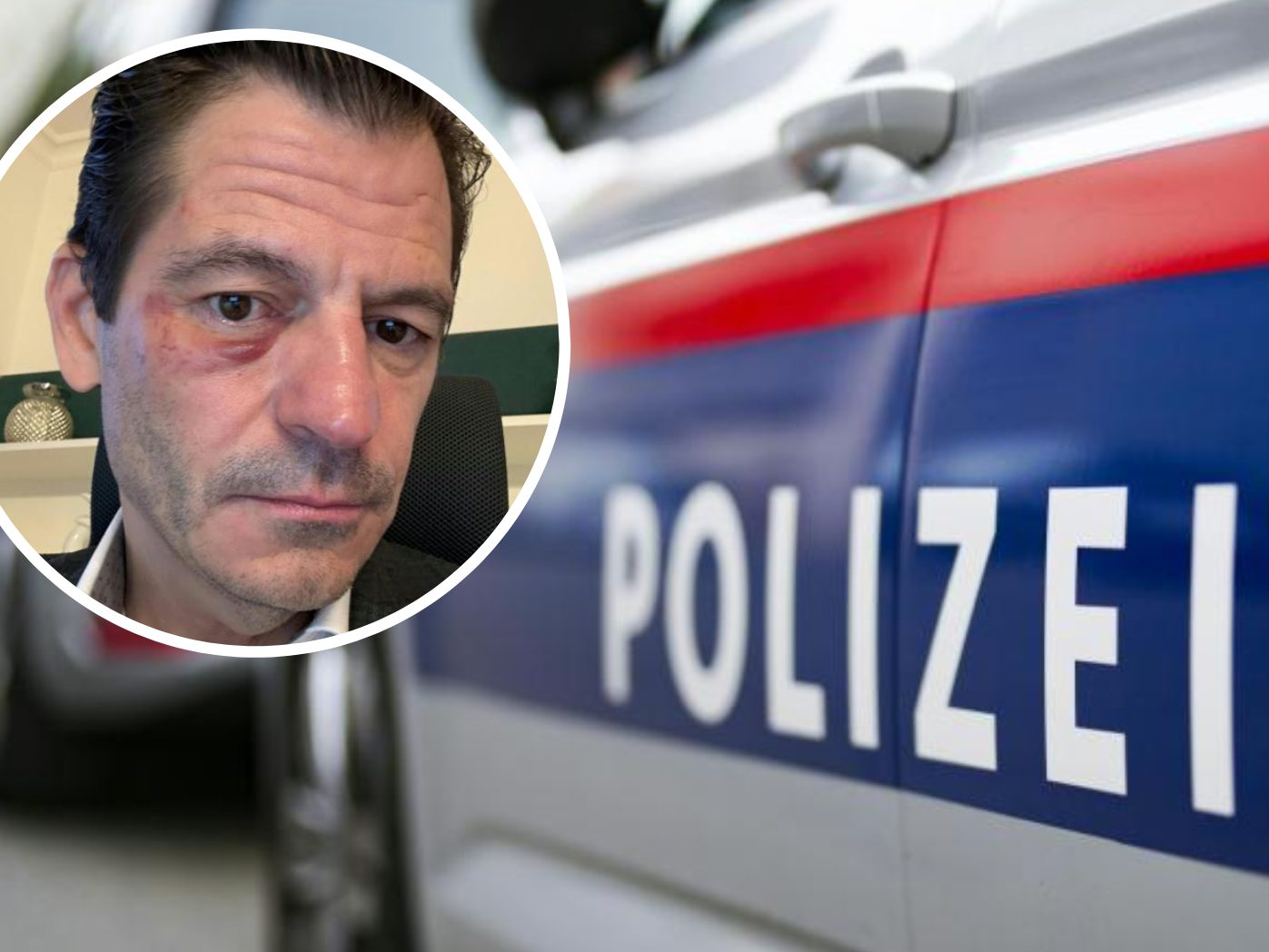 Die Polizei ermittelt nach dem Angriff auf Bürgermeister Koza weiter. Die Polizei ermittelt nach dem Angriff auf Bürgermeister Koza weiter.