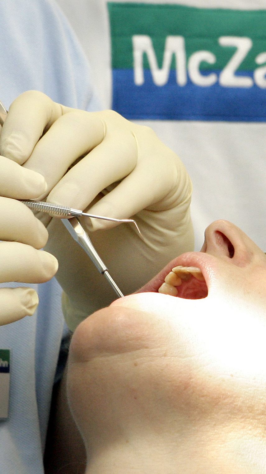 Amalgamverbot - Einigung zwischen BVAEB und Zahnärztekammer (Symbolbild)