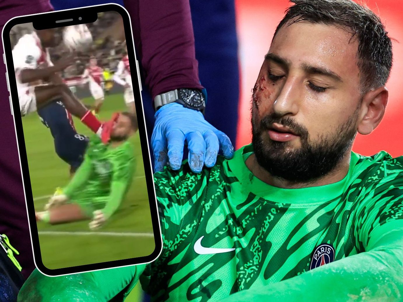 Gigi Donnarumma erhält medizinische Hilfe nach einem Zusammenprall mit Monaco's Wilfried Singo.